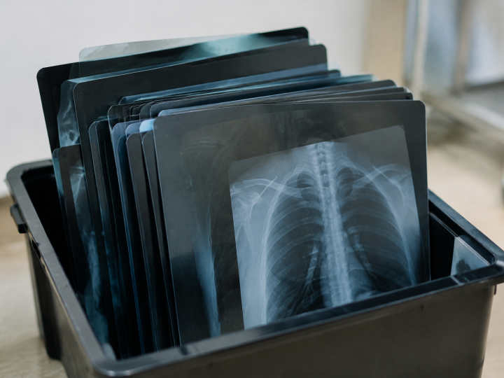 Radiographies medicales debout empilees dans bac noir